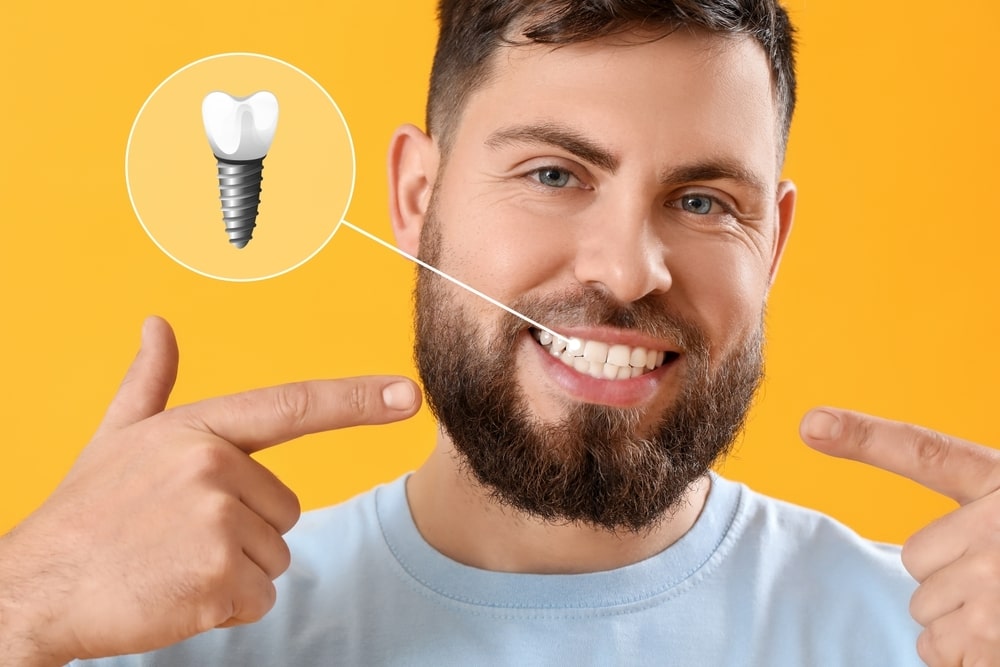 dental implants near you
