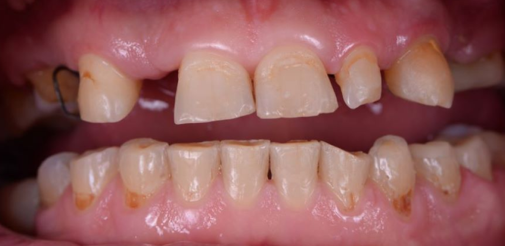 Before image
