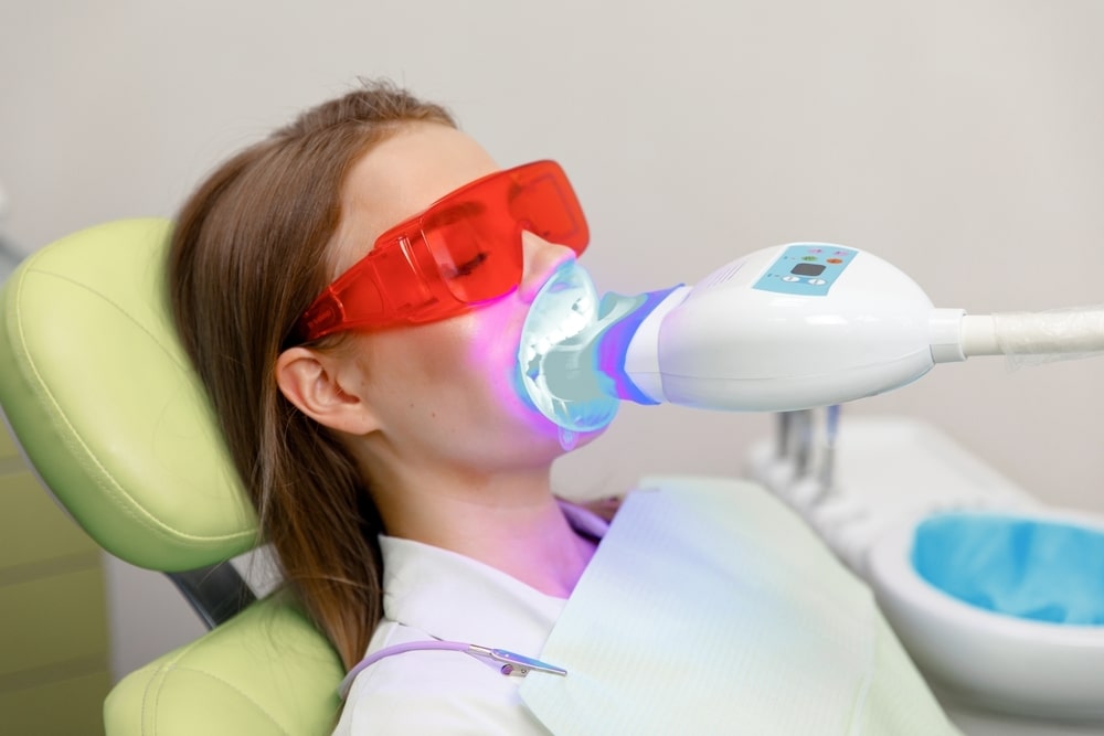 teeth whitening in fort mcmurray