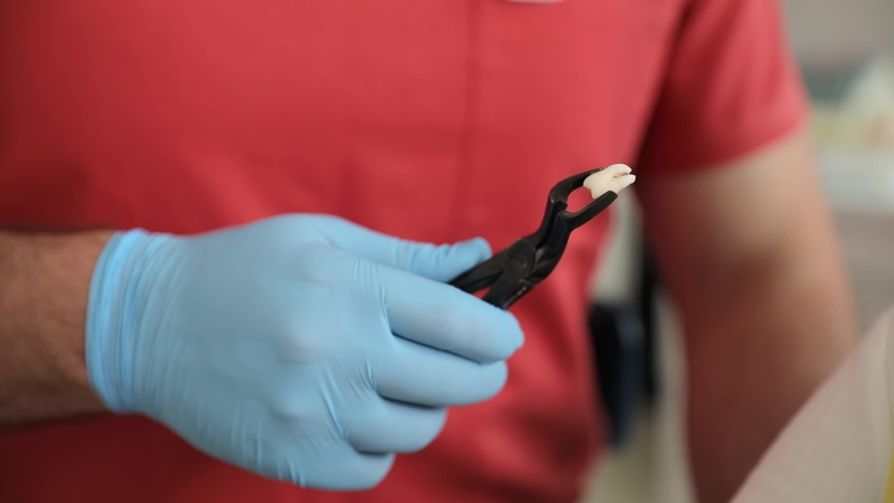 wisdom tooth extraction in fort mcmurray