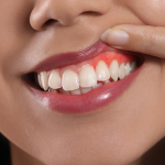 Why Your Gums Keep Bleeding Even Though You Brush_ 6 Everyday Habits Sabotaging Your Oral Health