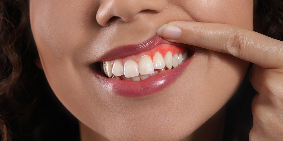 Why Your Gums Keep Bleeding Even Though You Brush_ 6 Everyday Habits Sabotaging Your Oral Health