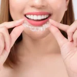 invisalign treatment duration