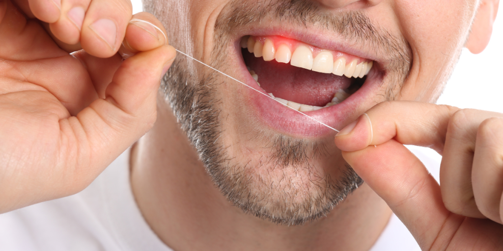 ➨ Habit #2_ Improper or Infrequent Flossing