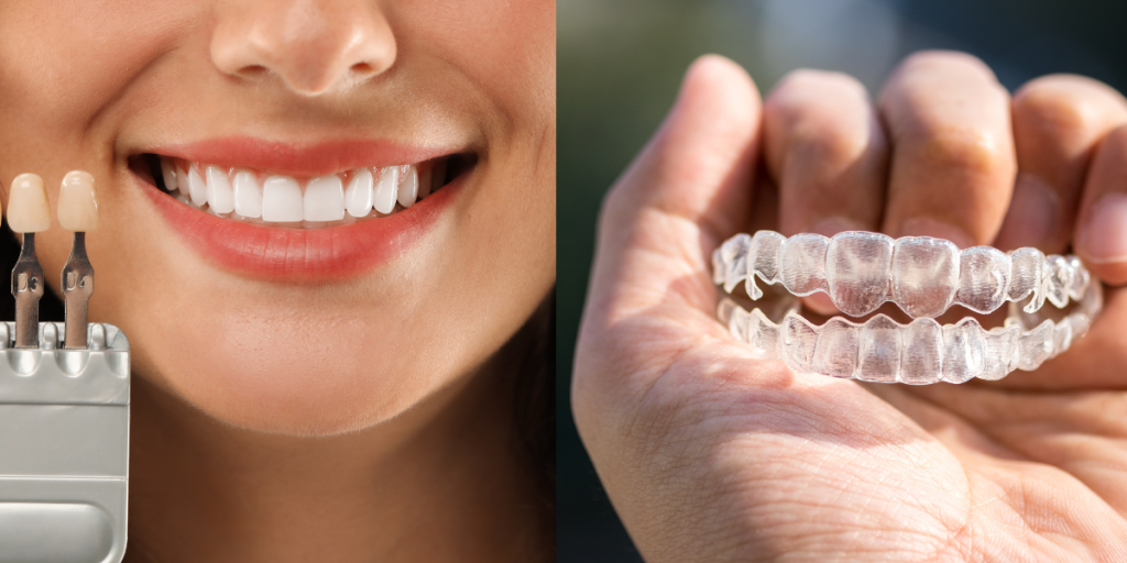 Invisalign Vs Veneers Fort McMurray 