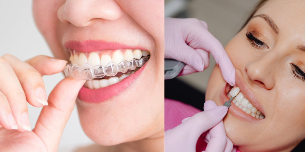 Invisalign vs Veneers_ Feature image