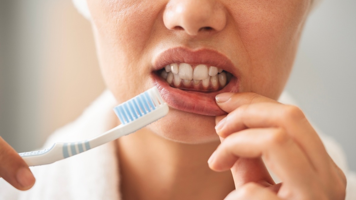 is it normal for gums to bleed when brushing