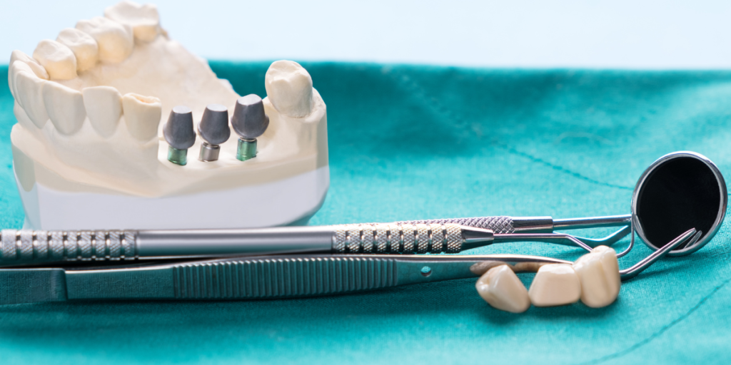 During Same-Day Dental Implants: What Happens