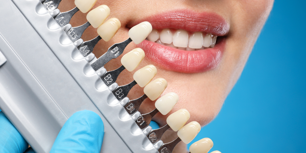 Understanding Tooth Color