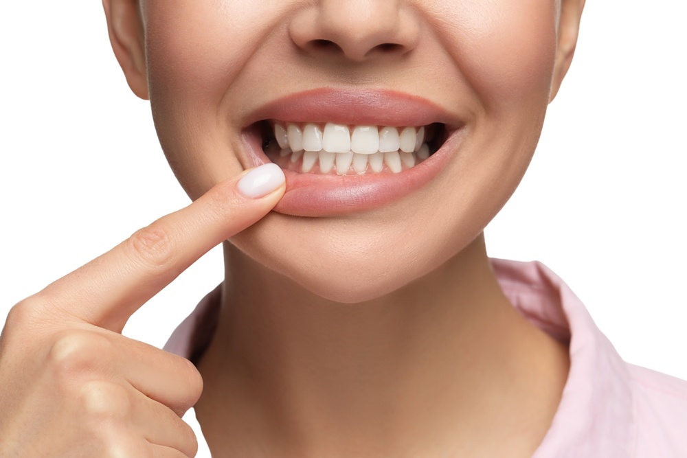 common causes of yellow teeth