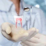 dental implants: what the procedure looks like from start to finish